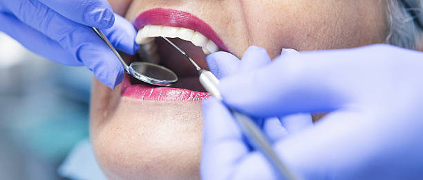 Best Emergency Dental Extractions in Mantua, UT